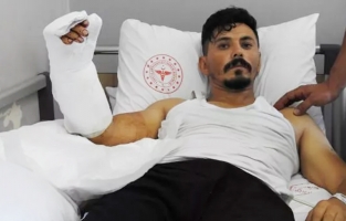 Fırın işçisi elini hamur makinesine kaptırdı, 12 saatte yerine dikildi!