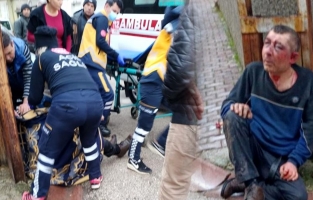 Fırın işçisini öldüresiye dövüp evinin önüne bıraktılar